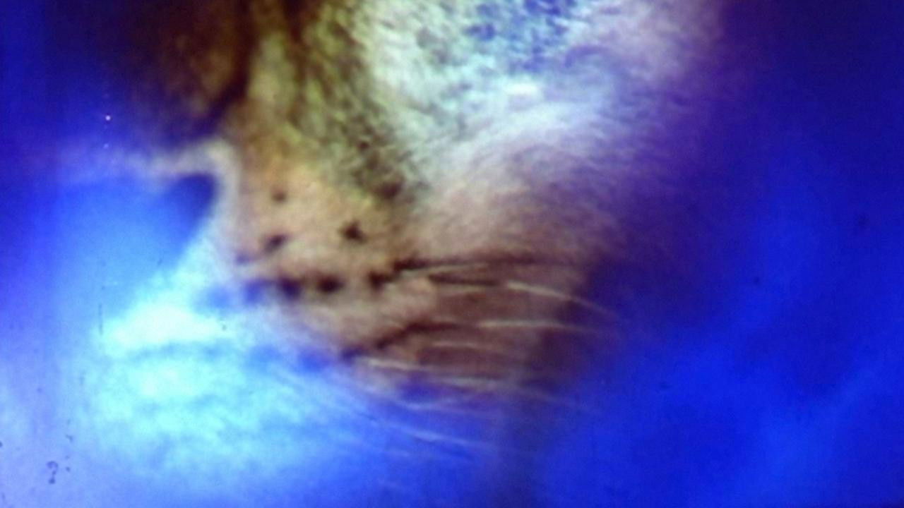 Quick Billy Background