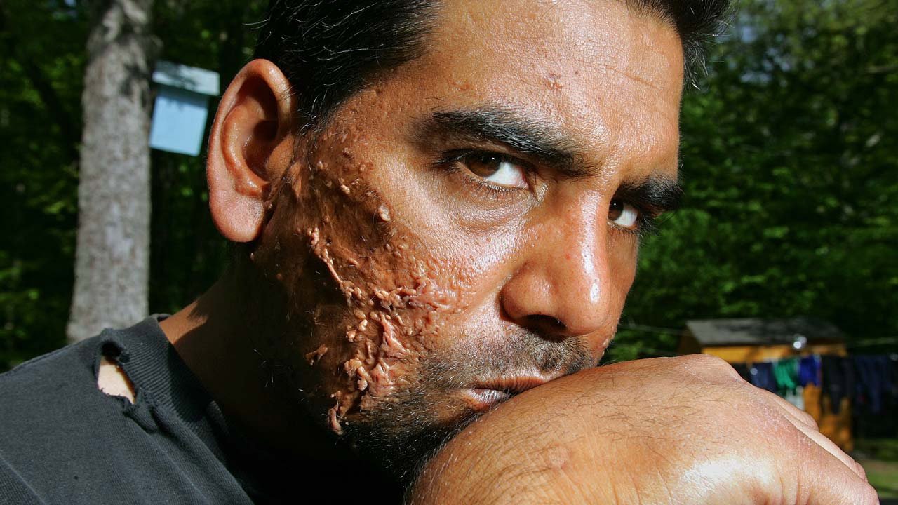 Mann v. Ford Background