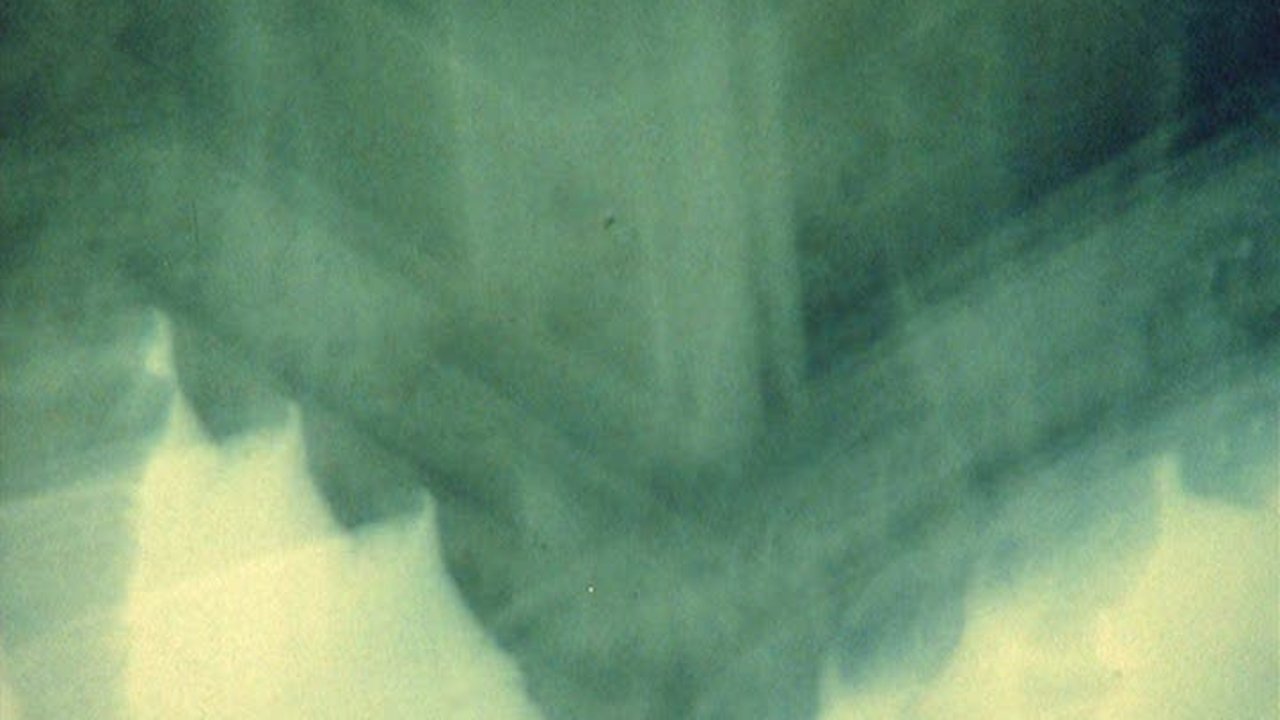 Unconscious London Strata Background